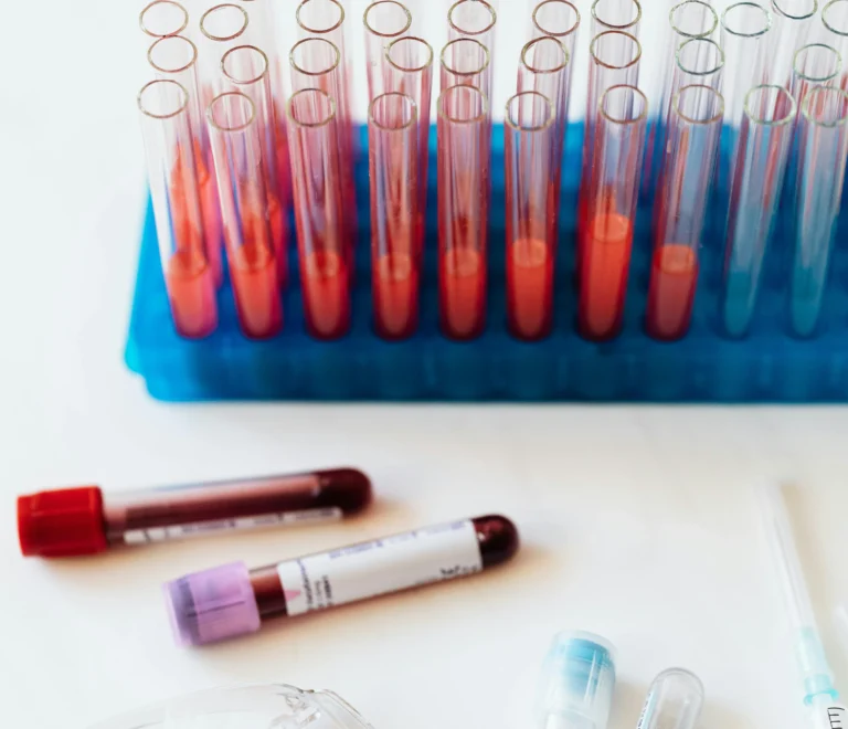 Blood CP Test Price in Pakistan ,Blood tests guides